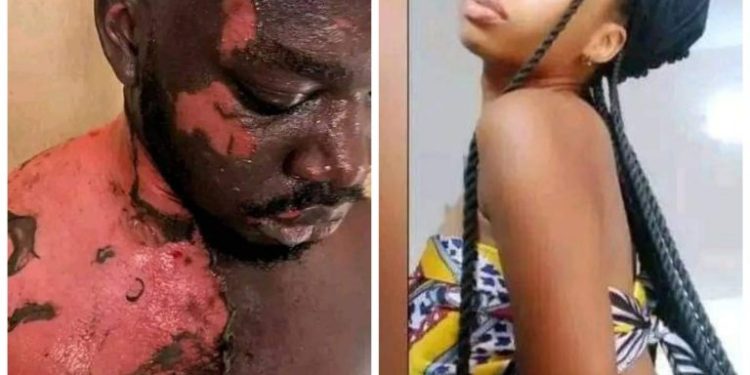 Heartbreaking Incident: UNIZIK Student Scalds Hostel President with Hot Water